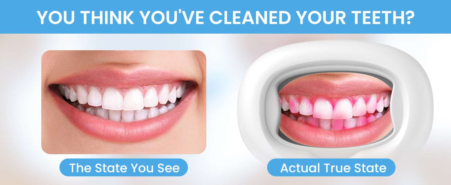 Dental Plaque Detector Plaque Disclosing