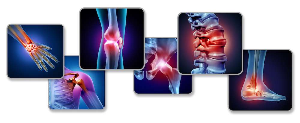 Pain Of The Joints Pain Of The Joints